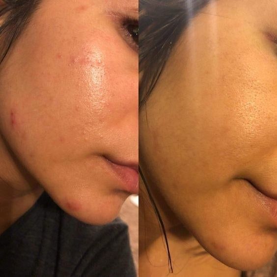 ACURE Brightening Facial Scrub